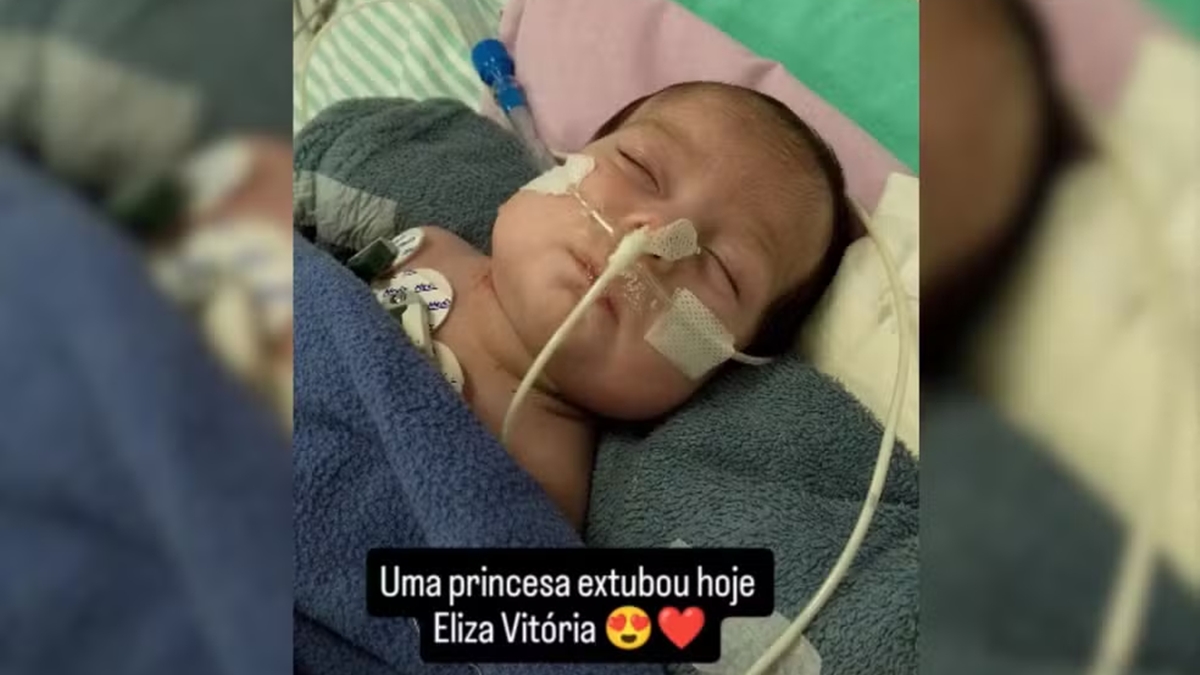 Gêmeas passaram por cirurgia com a equipe do médico Zacharias Calil